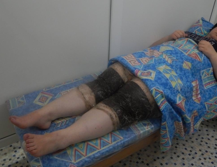 Оздоровительные услуги - Санаторий «Ислочь» Беларусь